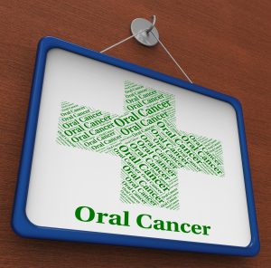 oral cancer sign